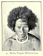 Hula man, Papuo-Melanesian type