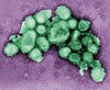 Virus selesema babi dilihat melalui mikroskopi elektron pancaran