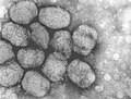 Electron micrograph of smallpox virus, similar to what Geddes would have seen in Parker's sample.[17][24]