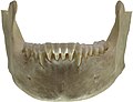 ヒトの顎骨（正面図）