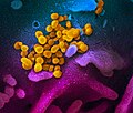 SARS-CoV-2 (žuta) u nastajanju iz ljudske ćelije