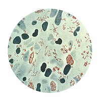 Мікрофотографія Mycobacterium leprae