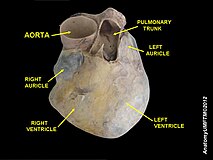 심장의 해부학 표본