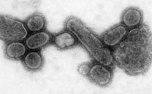 Reconstructed Spanish Flu Virus.jpg