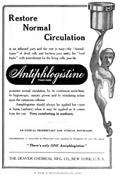 A black-and-white rectangle. On the left a stylized heroic nude holds a pot over his head. The title is Restore Normal Circulation. It is followed by pseudo-scientific jargon. The words "Antiphlogistine TRADE MARK" are highlighted in a rounded rectangle. The advertisement has a footer with "THE DENVER CHEMICAL MFG. CO., NEW YORK, U. S. A.