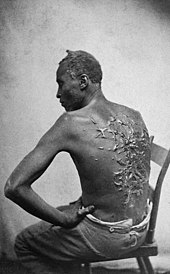 Man sieht den nackten Rücken des entkommenen Sklaven Whipped Peter, der auf einem Stuhl sitzt. Sein Rücken ist sehr stark von Peitschennarben gezeichnet.
