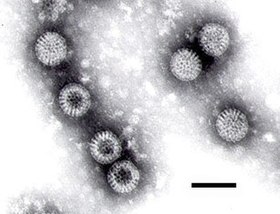 Rotavirus (Reoviridae) Escala = 100 ηm