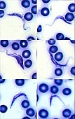 Trypanosoma cruzi in blood Giemsa stain