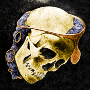Restos de un cráneo con la típica diadema de plata argárica