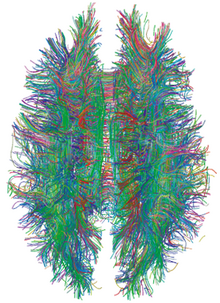 Тракти білої речовини в мозку людини, візуалізовані МРТ-трактографією
