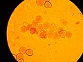 Apple pollen under microscopy