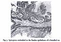 Eine Nematode, die in das Epithel des Magenfundus eingebettet ist[31]