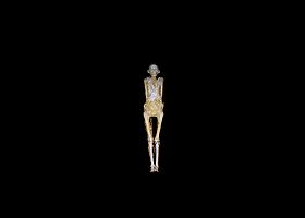 Kompiuterinės tomografijos būdu nuskenuota egiptiečių mumija Izraelyje