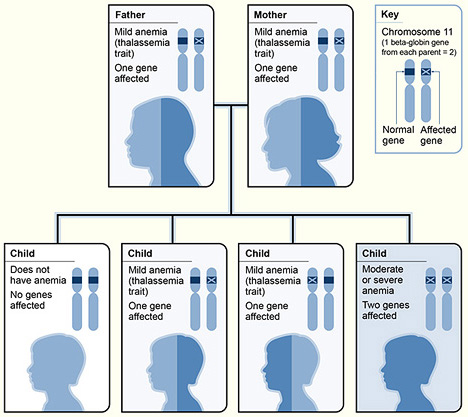  Picture shows an example of how alpha thalassemia is inherited