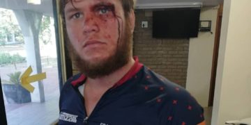 Stellenbosch cyclists attack