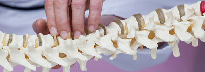 Roseville CA Chiropractic Clinic Talks About Bulging Discs