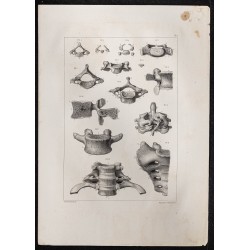 Gravure de 1864 - Nombreuses Vertèbres - 1