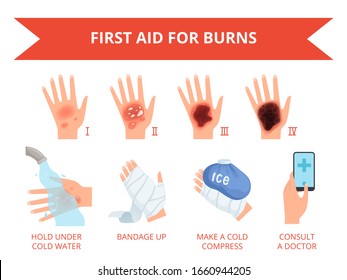 皮膚を焼く。人のベクターインフォグラフィックスに対する人間の手での火災または化学破壊損傷の重量皮膚の安全性を最初に治療するのベクター画像素材