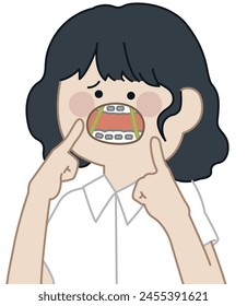 a girl using Orthodontic rubber bands, open mouth -flat illustration  Arkistovektorikuva