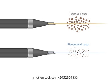 Difference of normal laser and Pico laser when shooting for breaks a dark spots on human skin layer into smaller fragments. Stockvektorkép
