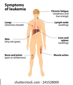 How to Recognize the Signs of Leukemia. blood cancer Stock-vektor