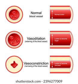Vasoconstriction and Vasodilation of an artery. Lumen of vein. Cross section of the blood vessel with red blood cells. comparison of normal, constricted, and dilated blood vessels. Vector illustration Stock vektor