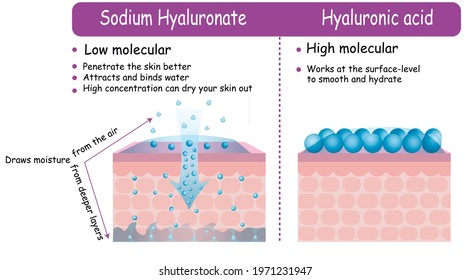 Vector Infographic Hyaluronic acid and Sodium Hyaluronate comparison scheme. Difference effect on skin low molecular penetration skin layers. Dermatology hydration explained keep moisture beauty care  Immagine vettoriale stock
