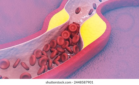 Bad cholesterol in blood. 3d illustration		 Stock Ilustrace