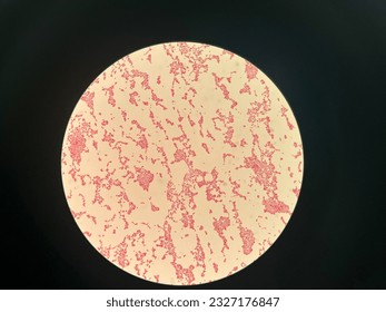 Bacterial staining Neisseria sicca under microscope in the Laboratory Arkistovalokuva