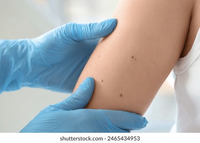 Dermatologist examining moles on young woman in clinic, closeup Stockfotó
