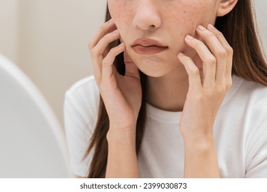 Dermatology, expression face worry asian young woman looking mirror hand touch face at dark spot of melasma, freckle from pigment melanin, allergy sun. Beauty care, skin problem treatment, acne care. Stockfotó