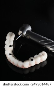 口腔外科専門医が全く無歯の顎に対してall-on-4、all-on-4、およびall-on-X治療プロテーゼのフルアーチ口腔内に装着する。歯列矯正用インプラントで完全に支持される人工全体。




の写真素材