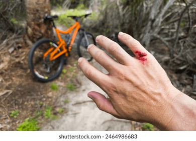 マウンテンバイク事故。木の切り株に赤い血を流して負傷したライダーの手の写真素材