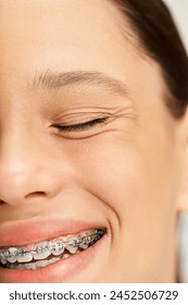 Una adolescente con estilo, con un atuendo vibrante sonríe alegremente, mostrando sus frenillos en los dientes. Foto de stock