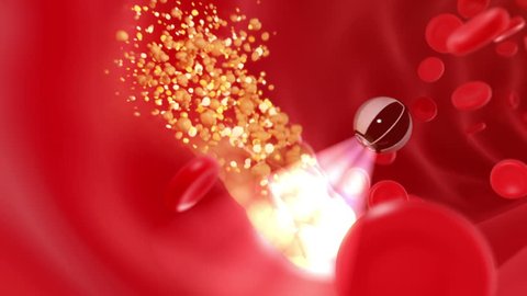 Nanobot finds and removes forming cholesterol plaque, abstract conceptual 3d animation. full HD 1080 Stock video