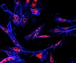 New biological mechanism uncovered for treating breast cancer metastasis to the brain