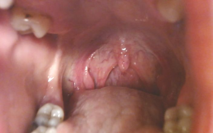 TLC 1992: Throat and Mouth Spit Strings Uvula Tonsils Uvula