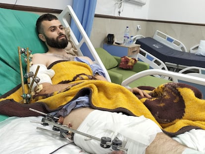 Myahed Abadi, en el hospital de la ciudad cisjordana de Yenín en el que se recupera de las heridas, este lunes.