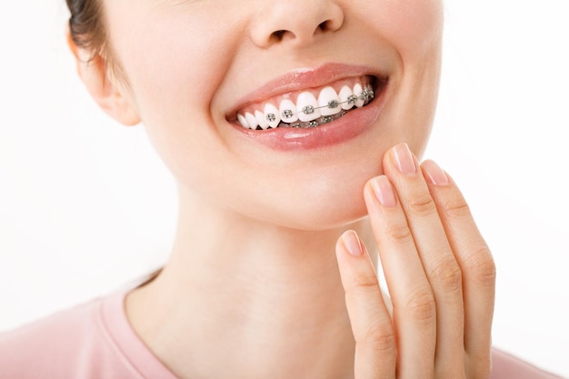 Foto tratamiento de ortodoncia concepto de cuidado dental hermosa mujer sonrisa saludable cerrar primer plano soportes de cerámica y metal en los dientes hermosa sonrisa femenina con frenos