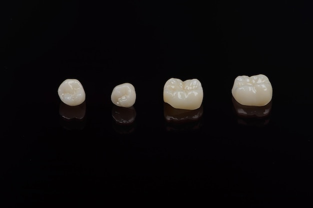 Cerámica anatómica calificada y coronas de zirconia de dientes humanos cerca de macro aislado en negro