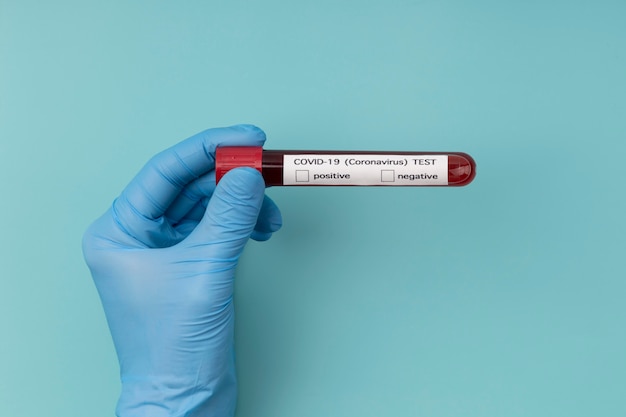 Free photo coronavirus blood sample arrangement in lab