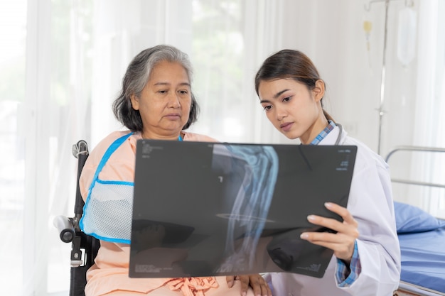Доктор Информ результаты медицинского осмотра рентгеновской пленки для поощрения пожилой пожилой женщины Пациенты со сломанной рукой в больнице - медицинская концепция старшего возраста