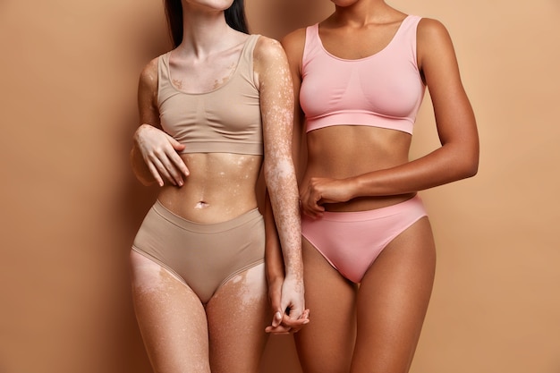 Free photo every body is beautiful. two women of different race and skin conditions dressed in lingerie