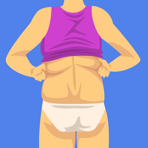 Вектор Часть женского тела человеческая фигура после потери веса обратный взгляд ожирение и проблемы с нездоровым питанием векторная иллюстрация плоский стиль