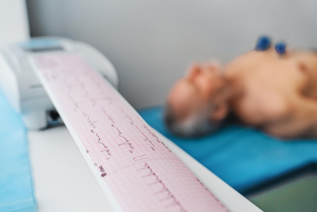 ECG Cardiogram printout on male patient background