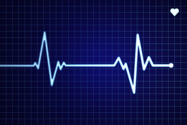 Foto elettrocardiogramma su uno schermo a griglia blu