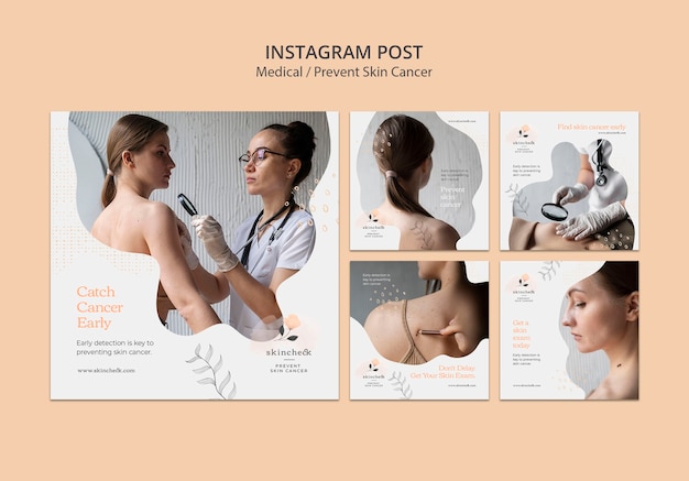 Coleção de postagens do instagram para prevenção do câncer de pele