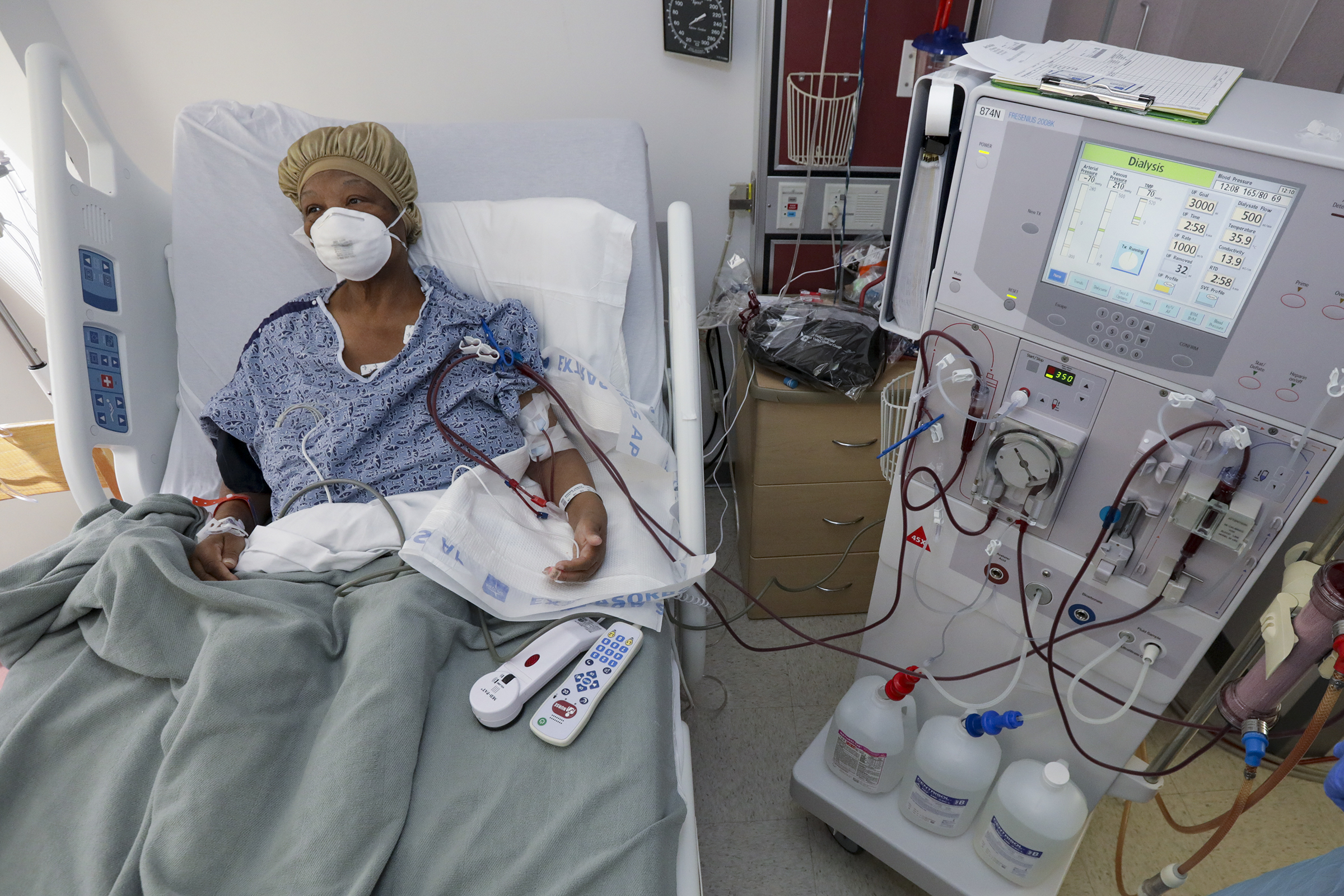 Dialysis is a miraculous technology, but compared to transplants, it’s awful.