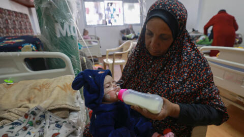 Un enfant palestinien souffrant de malnutrition est traité à Rafah le 5 mars 2024.