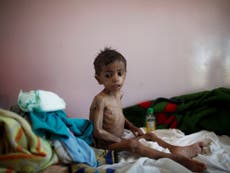 Starvation in Yemen so bad people are eating from rubbish dumps